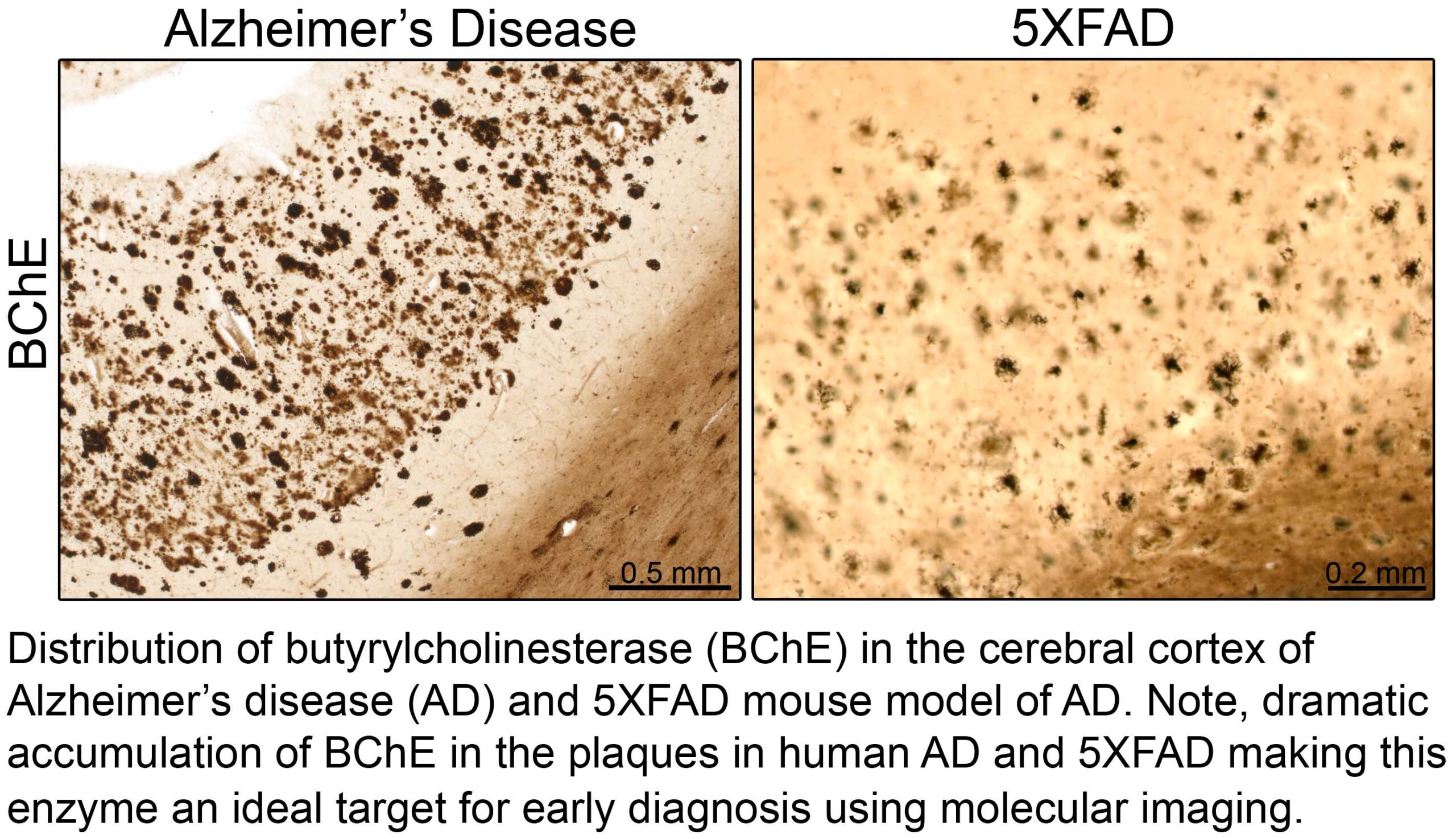 AD Human vs 5XFAD BChE